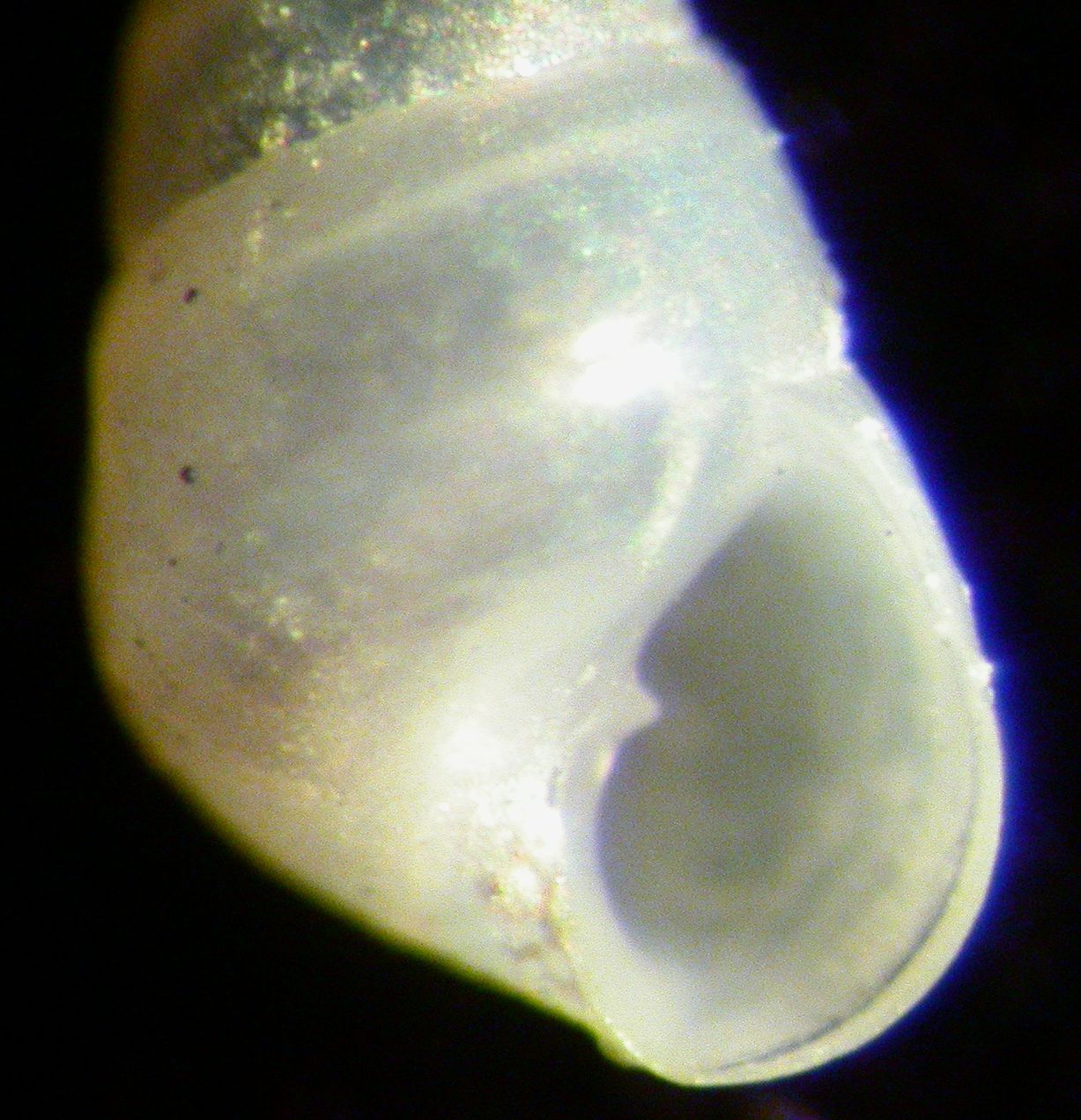 Odostomia conoidea?